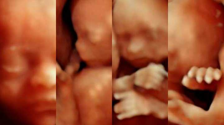 Fotografia tomada fuera de Dr. Elizarraras, Ultrasonido 3D/4D y más - Médico en San Pedro Pochutla, Oax.