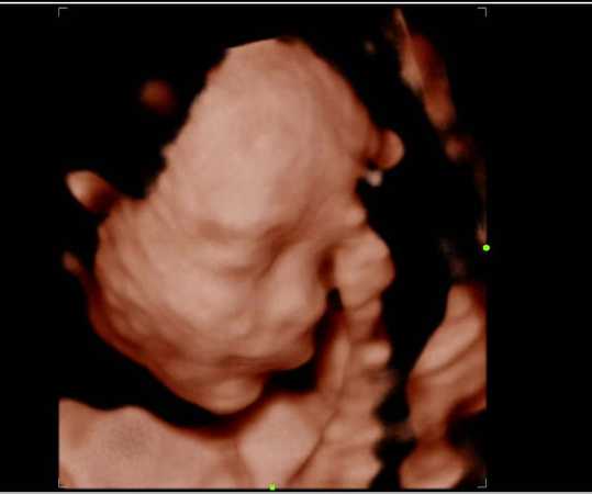 Fotografia tomada fuera de Clinica San Carlos - Hospital de maternidad en Guadalupe, N.L.